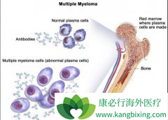 �����ᱻ����Ķ෢�Թ�����֢״����Щ