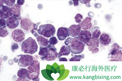 ����������(Ristova)���ϱ�׼�����ɸ��Ʋ������ܰ������ߵ�EFS��