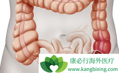 ��ά͡(Avastin)�ͻ��Ƶĳ�������ʱ��������ߵ�Ԥ��Ч��