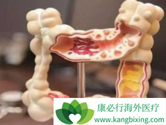 ������/�����������Լ������ܹ���VEGF���ƵĻ�����Ч