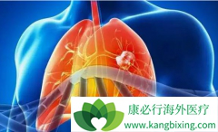 �ΰ�����֮�����Ʒ��ͻ�ѧ�Ʒ��Ľ���