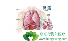 �ǹؽڲ������Ƿΰ����ڵ�֢״֮һ