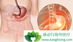 ��������(Apatinib)����S-1�ɽ�һ���������θ�����ߵ�DCR