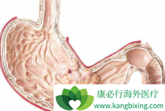 ���ð�������/��̹����ַ���֢״��Ҫ������