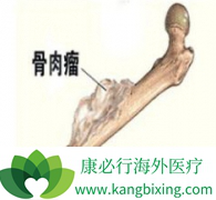 ����ҩ�ﰢ������(Apatinib)�����ƹ�������ת����