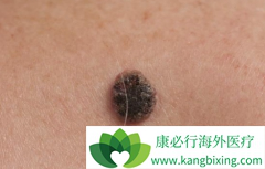 ���޷���(Zelboraf)��MEK���Ƽ����ÿ��ӳٵֿ��ԵĲ���