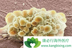 ��Ī������߱����鵥��(Bevacizumab)���ƽ���������Ч��