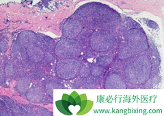 ��������������������/���޻������������ܰ������ߵ���Ч��