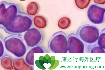 雷利米得 雷利米得