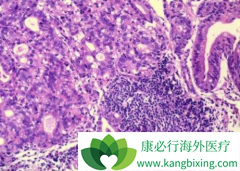 ��ɳ����(Oxaliplatin)�ܷ����ϻ�������ƽ�չ��θ��