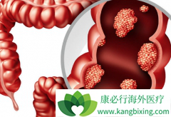 ��������(Capecitabine)��Ⱦ���5FU�Ի��߶������Ƹ���