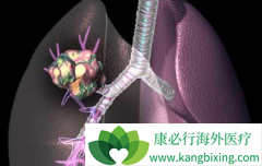 ��Ī«����(Cyramza)����������Щ��Сϸ���ΰ�����