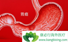 ������(REGORAFENIB)���ӳ�����θ�����������ڷ�����Ǳ������