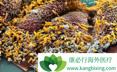 ��άĪ˾(Afinitor)�ܸ��ƽ�չ��θ�����ߵ���������