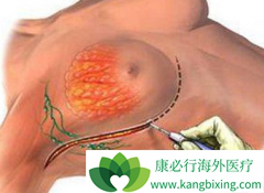 �������ٰ����߷��ð�������(anastrozole)���Ƿ�ά˾Ⱥ