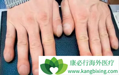 ������״ָ�Ƿ���Ƿΰ�����״ָ��ʲô��