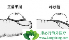 �ΰ���֢״������״ָ֮�⻹����Щ��