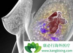 ����ҩ����������(Ibrance)���������������ٰ�����