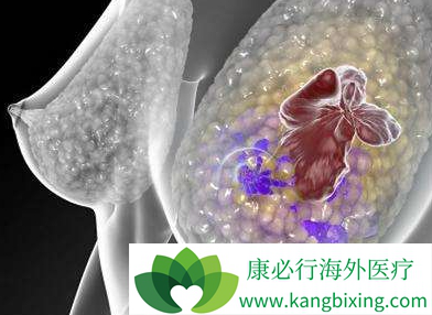 帕博西尼 帕博西尼