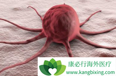 CAR-Tϸ�������Ʒ����ƶ��Խ�������˷��������ƻ���