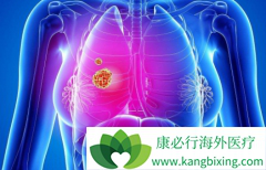 ��������ʱ�ɰ�ÿ��һƬ�����޿�/���������Ϊ��Ƭ