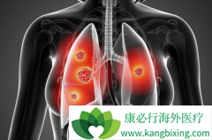 ��������(ERLOTINIB)�����ڼ������Щ�������Ӧ���Ժ���