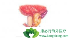 ǰ���ٰ��ķ������ؼ�ת��;������Щ