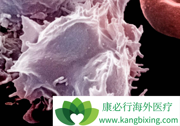 格列卫不良反应 格列卫不良反应