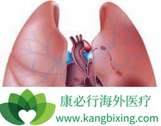 ���·���ά��������ԭ����ʲô