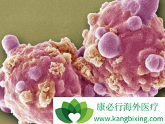 ʩ����(Sprycel)�ܴ���Ѫ����������BCR-ABL���Լ��԰�Ѫ��