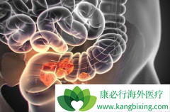 ���ᵥ��(Panitumumab)���뻯�����϶�������ת���Խ�ֱ������