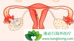 ��ķ����(pembrolizumab)����niraparib�����ѳ����ȵ�ҩ���Ը�