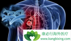 �ΰ�ҩ��̩��ɳ(AZD9291)�����Ʋ�ͬ���͵Ļ���ʱ�÷���ͬ