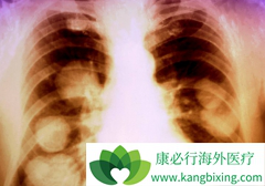 ���ڷΰ����߷׷׹���ӡ�����޿����Ĵ�����