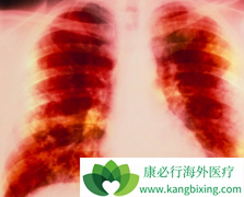 ���ڷΰ����߷������޿�/���������������ʲô�仯