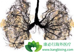 �ΰ����߼������ð�������(GILOTRIF)��Ч�Ƿ���½�