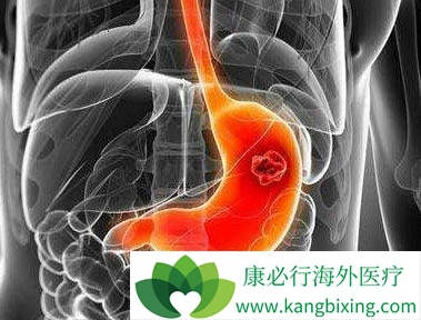 奥拉帕尼 奥拉帕尼