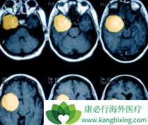 ��̹(sunitinib)����������Ĥ������Ч�ʿɴ�42%