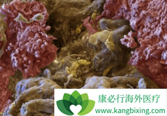 ��������(Cabozantinib)�����ڼ仼���ܳ���ҩ��