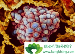 ���ֲ�����Ӧʱ������ε�����������(Cometriq)��ҩ����