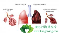 �ΰ���ת�ƵĲ�����Ч���Ʒ���