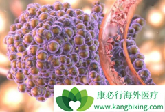 PD-1ҩ��ŷ����/���䵥���������޿��Է�Сϸ���ΰ��Ŀ�����Ϊ65%