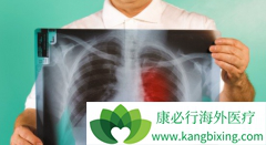 ��������(brigetin)�԰���������ҩ���ߵļ���������Ϊ67%