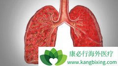 ��������(Alunbrig)��ҩ����Ϊ����ʱ���߻�õ��޽�չ�������