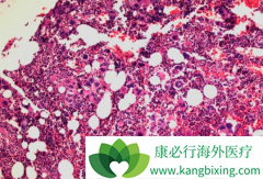 ����ҩ��³������(jakavi)�����еĹ�����ά�����߶���Ч��