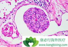 ��������(Tykerb)�����׼�����ܷ���ư�����·��Ƥ�����߽��