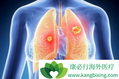 ��������(xalkori)�������ڷΰ��������ܳ�������