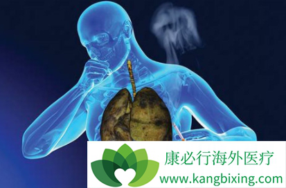 卡博替尼 卡博替尼