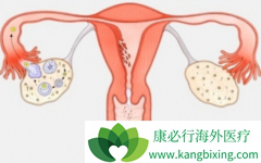 ����ҩ���������(Olaparib)/����׿��ʹ�÷�Χ