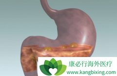 θ�������������߷��ø�����(Imatinib)Ҫע�������